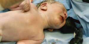 A uterine rupture must be quickly identified and treated, most typically by performing emergency c-section to prevent catastrophic outcomes for both mother and baby